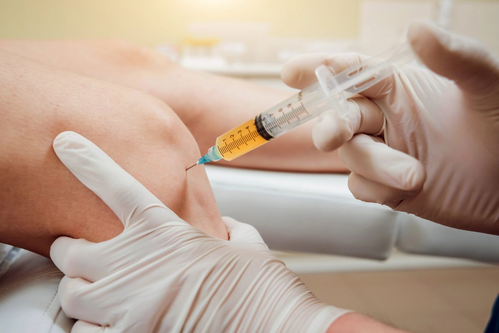 PRP Therapy for Knee Arthritis