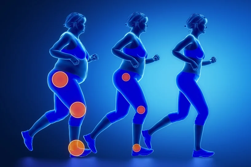 How Overweight Affects Your Knees and Joint Health